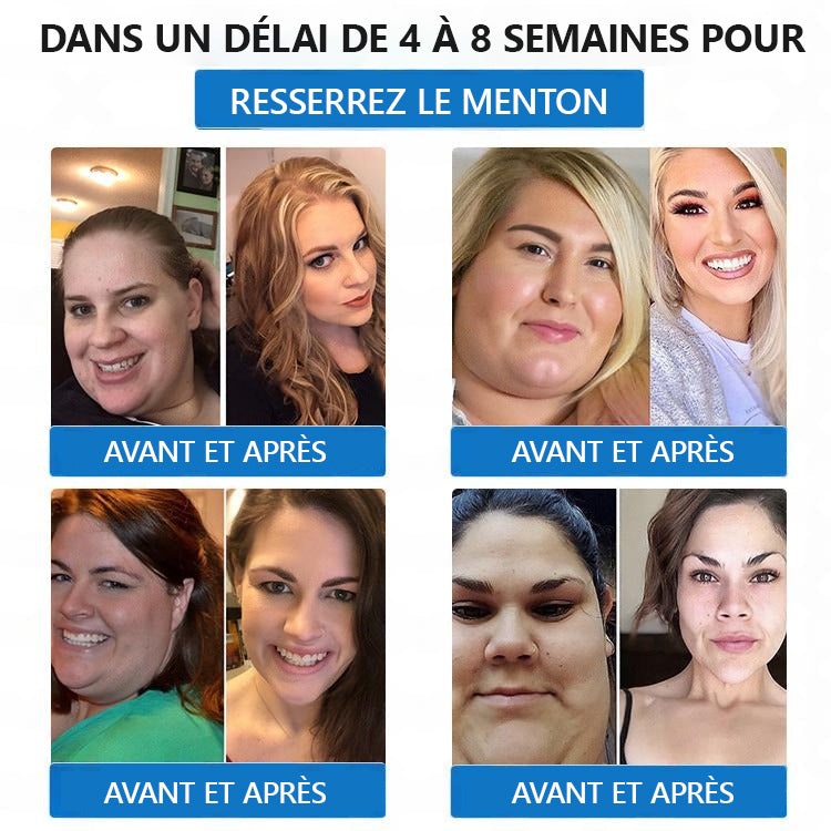 【Dernier jour de promo - 60% de réduction🌟】🎖️🎖️𝑳𝒆𝒓𝒄𝒆𝒂® 𝐏𝐚𝐭𝐜𝐡 𝐍𝐀𝐍𝐎-𝐌𝐢𝐜𝐫𝐨𝐧𝐞𝐞𝐝𝐥𝐞𝐬 𝐒𝐚𝐧𝐭é & 𝐌𝐢𝐧𝐜𝐞𝐮𝐫(Sans douleur · Libération continue 24h/24 · Perdez 9 kg RAPIDEMENT · Réduction de sucre jusqu’à 90 % )✅