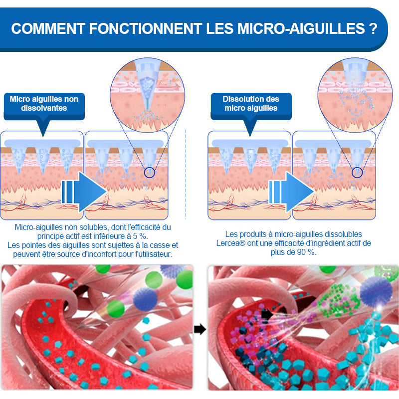 【Dernier jour de promo - 60% de réduction🌟】🎖️🎖️𝑳𝒆𝒓𝒄𝒆𝒂® 𝐏𝐚𝐭𝐜𝐡 𝐍𝐀𝐍𝐎-𝐌𝐢𝐜𝐫𝐨𝐧𝐞𝐞𝐝𝐥𝐞𝐬 𝐒𝐚𝐧𝐭é & 𝐌𝐢𝐧𝐜𝐞𝐮𝐫(Sans douleur · Libération continue 24h/24 · Perdez 9 kg RAPIDEMENT · Réduction de sucre jusqu’à 90 % )✅