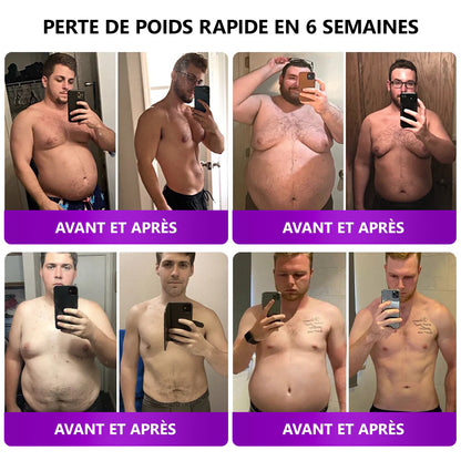 30% de réduction[Voir les résultats en 7 jours]🍀𝑳𝒆𝒓𝒄𝒆𝒂®  𝑺𝑴𝑮𝑻-𝑮𝑳𝑷-1 Patch Amincissant à Micro-Aiguilles Nano（Indolore et durable, il traite le diabète, l'obésité et les maladies cardiovasculaires）🍀