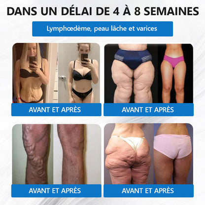 【Dernier jour de promo - 60% de réduction🌐】🌟𝑳𝒆𝒓𝒄𝒆𝒂® 𝐏𝐚𝐭𝐜𝐡 𝐍𝐀𝐍𝐎-𝐌𝐢𝐜𝐫𝐨𝐧𝐞𝐞𝐝𝐥𝐞𝐬 𝐒𝐚𝐧𝐭é & 𝐌𝐢𝐧𝐜𝐞𝐮𝐫（Sans douleur · Libération continue 24h/24 · Perdez 9 kg RAPIDEMENT · Réduction de sucre jusqu’à 90 % ）🌟