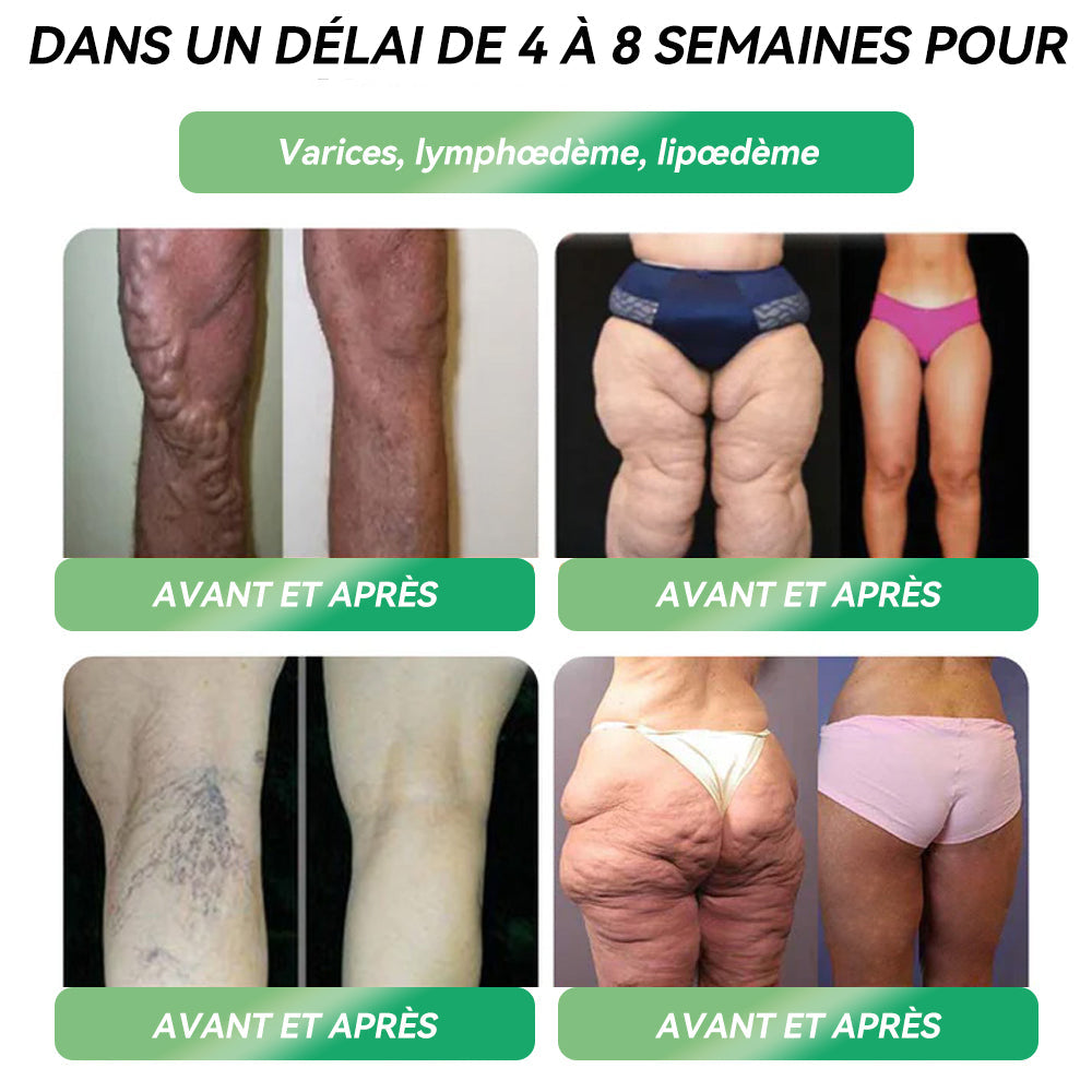 𝑩𝒐𝒖𝒕𝒊𝒒𝒖𝒆 𝑶𝒇𝒇𝒊𝒄𝒊𝒆𝒍𝒍𝒆🏆🏆|𝐋𝐄𝑹𝑪𝐄𝐀® Ampoules Orales Équilibre Métabolique GLP-1 Obésité, maladies cardiovasculaires, diabète, apnée du sommeil, troubles articulaires et autres affections